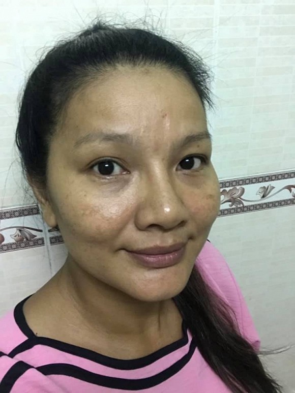 Hình ảnh gây sốc của Kiều Trinh hiện tại.