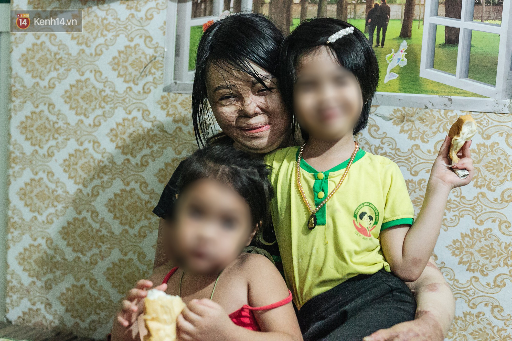 3 năm kể từ ngày định mệnh, Dung vẫn chưa thôi ám ảnh về những đớn đau mà từng lít xăng 