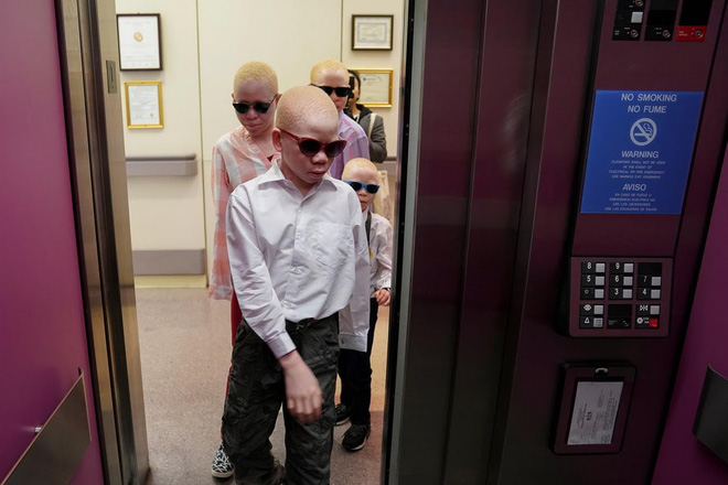 Hình ảnh những đứa trẻ bạch tạng người Tanzania ở các lứa tuổi 7, 14, 15 và 16 được điều trị ở Philadelphia, Mỹ. Chi phí đi lại, ăn ở và điều trị được một quỹ từ thiện có trụ sở ở New York chi trả.