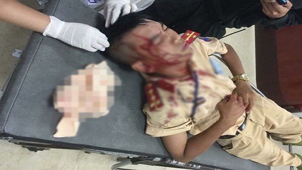 Đại úy Sơn bị đánh chảy máu đầu sau vụ tấn công (Ảnh: Infonet)