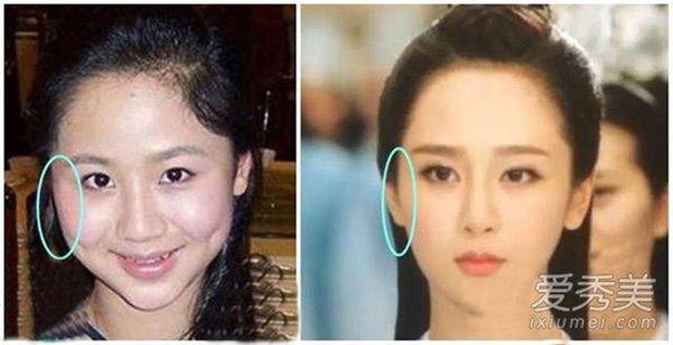 Thậm chí còn có nghi vấn hạ gò má