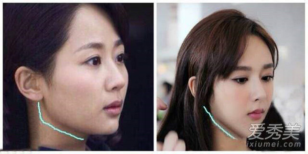 Hình ảnh so sánh xương hàm của Dương Tử có sự thay đổi bất ngờ