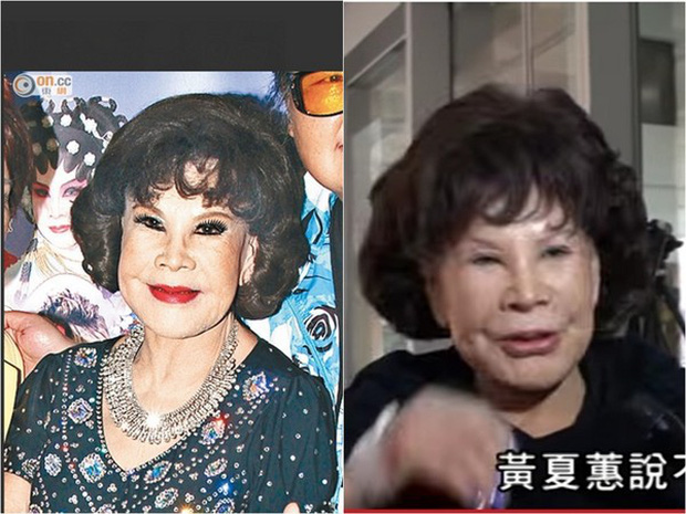 Bà trở nên như thế này