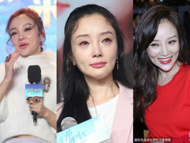 Lý Tiểu Lộ và những lần khiến dân tình phải hoảng sợ bởi gương mặt biến dạng