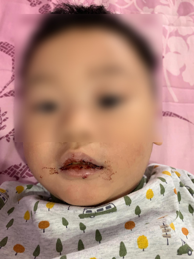 Sáng nào ngủ dậy mồm miệng cũng đầy máu đông cứng.