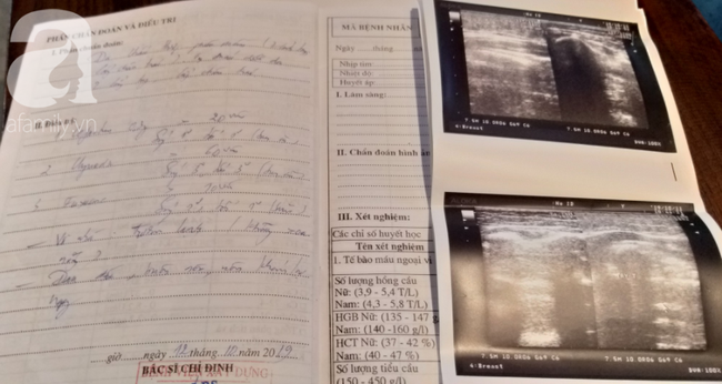 Phim chụp và đơn thuốc