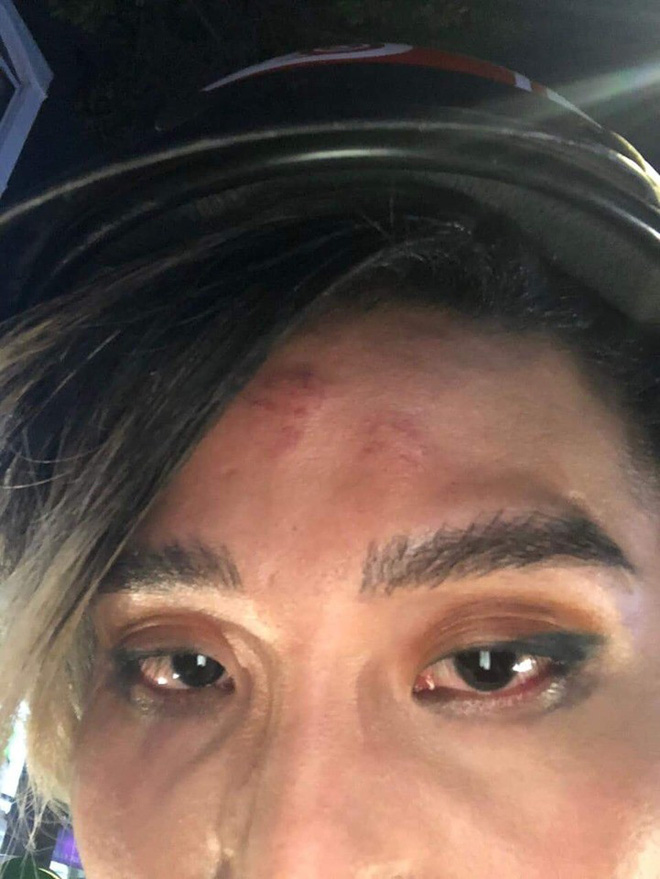 Nam người mẫu tố bị tài xế xe ôm công nghệ hành hung