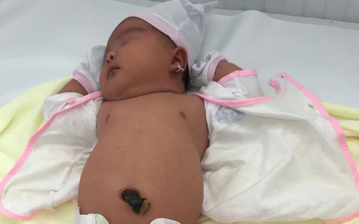 Hiện sức khỏe sản phụ ổn định, bé gái khỏe mạnh