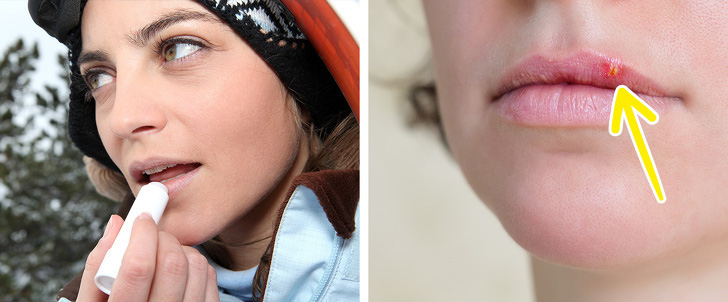 Việc dùng chung son môi, son dưỡng cũng có thể làm chúng ta lây truyền virus herpes cho nhau.