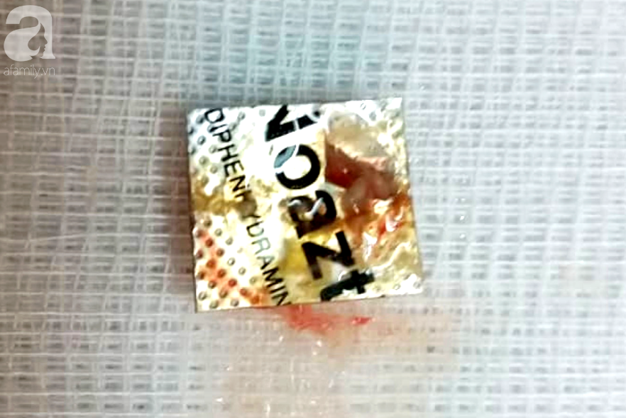 Dị vật sau khi lấy ra.