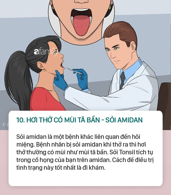 Lưu ý: Nhai kẹo cao su không làm cho hơi thở của bạn trở nên thơm tho