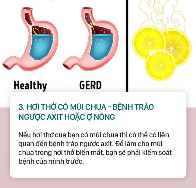 Thay đổi chế độ ăn uống của bạn và loại trừ một số loại thực phẩm như rượu, tỏi, thức ăn cay và cà phê cũng có thể giúp ích.