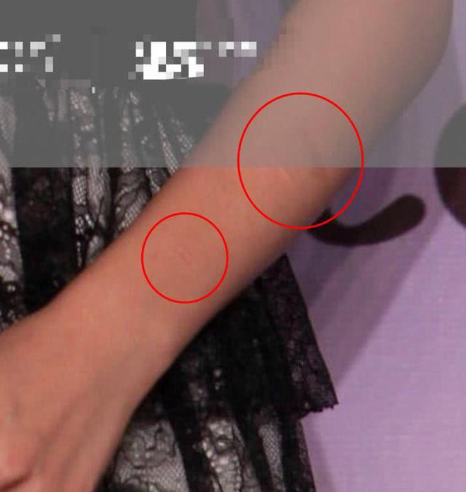 Hình ảnh cổ tay Dương Mịch xuất hiện những vết sẹo từ năm 2011