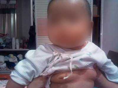 Ở nước ta tình trạng trẻ gái dậy thì sớm chiếm tỷ lệ cao hơn trẻ nam