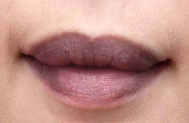 Môi thâm đen thể hiện chất độc trong cơ thể không được đào thải ra ngoài