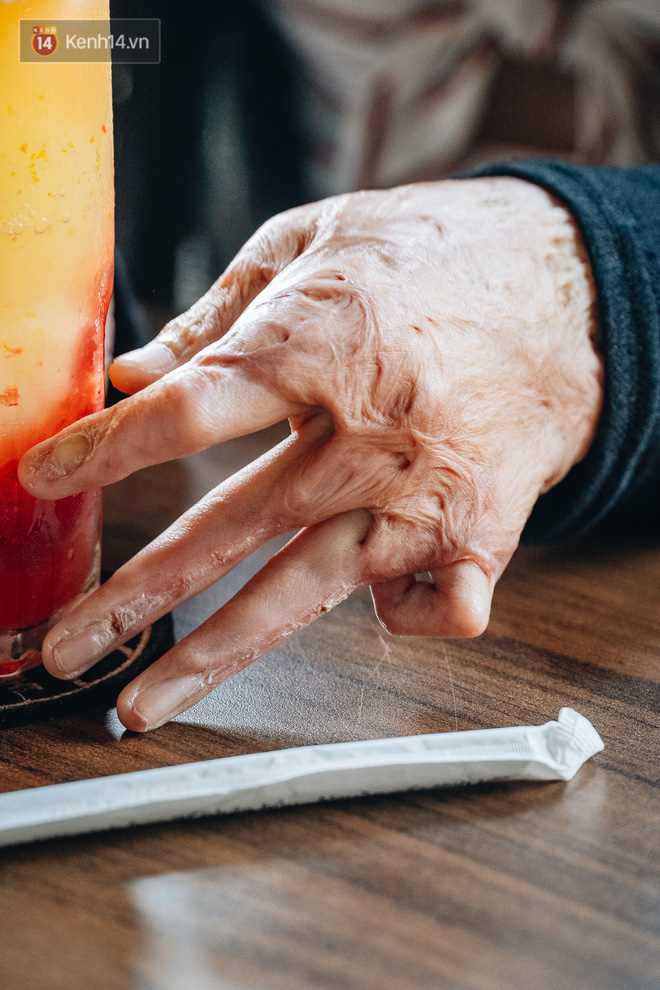 Tay và chân của cô vẫn chưa thể lành lặn, chằng chịt vết sẹo. 