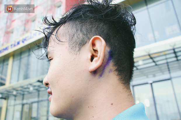 Một nạn nhân của kiến ba khoang chia sẻ.