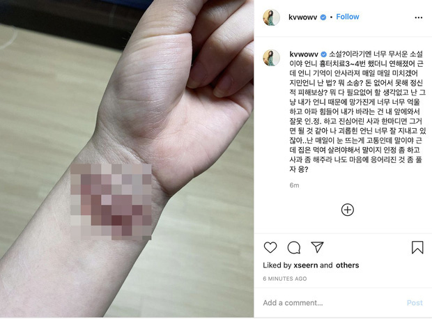 Hình ảnh cổ tay chằng chịt vết thương của Mina kèm những lời tố cáo Jimin.