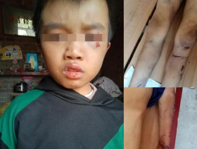 Đứa trẻ xấu số Khang Khang bị chính bố mẹ ruột sát hại.