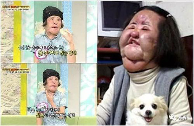 Hình ảnh trước và sau của Han Mi Ok có sự khác biệt