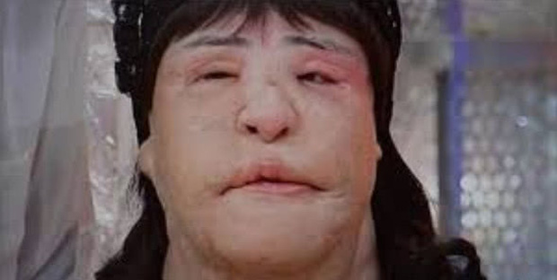 Sau 17 cuộc phẫu thuật, gương mặt của nữ diễn viên trở nên thon nhỏ hơn trước rất nhiều