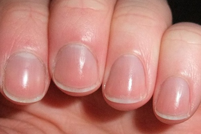 Nếu bạn có móng tay hồng hào, sáng bóng thì điều đó cho thấy mạch máu đang hoạt động trơn tru...