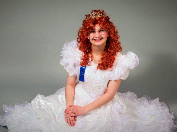 Dù bệnh tật nhưng nụ cười tươi tắn luôn nở trên môi cô bé Gypsy khiến người ta càng thương xót và khâm phục nghị lực phi thường.