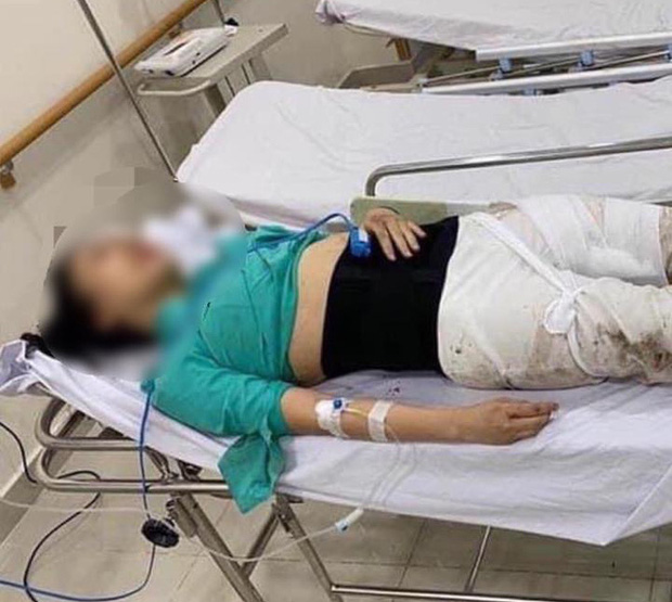 Nữ tiếp viên bị thương tật 79%