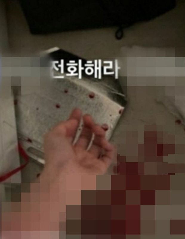 ... đã cắt cổ tay đến mức nhập viện