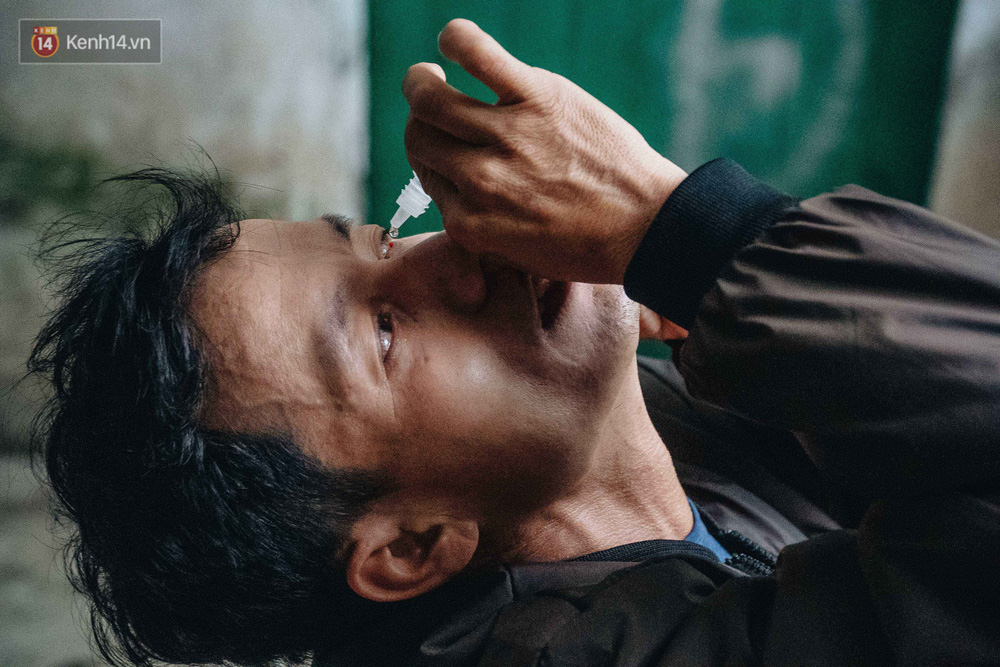 Anh Hùng vừa mổ một bên mắt bị đục thủy tinh thể, thường xuyên phải nhỏ nước mắt để chăm sóc