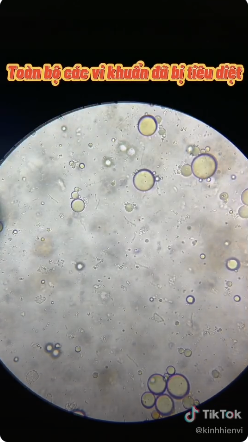 Hình ảnh món trứng cà chua dưới kính hiển vi.