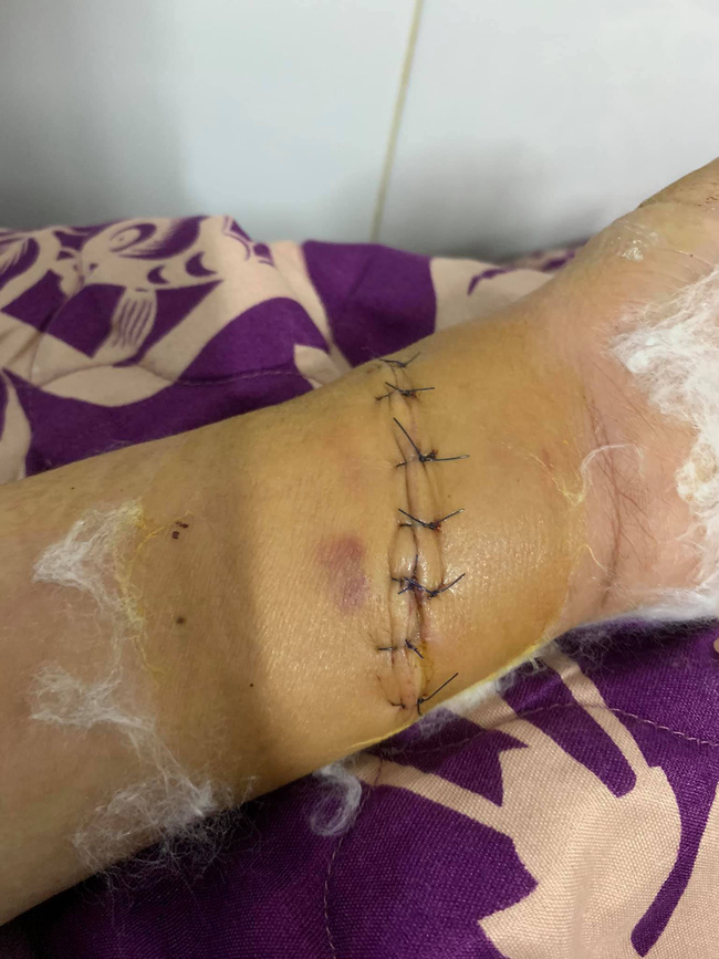 Cô vợ thậm chí đã làm chuyện tiêu cực sau khi biết chồng ngoại tình