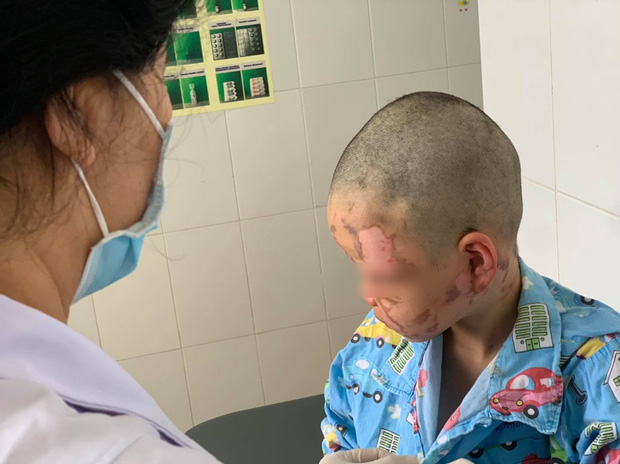 Bệnh nhi Đ.D.H. được các bác sĩ chăm sóc tích cực (Ảnh: BVCC)