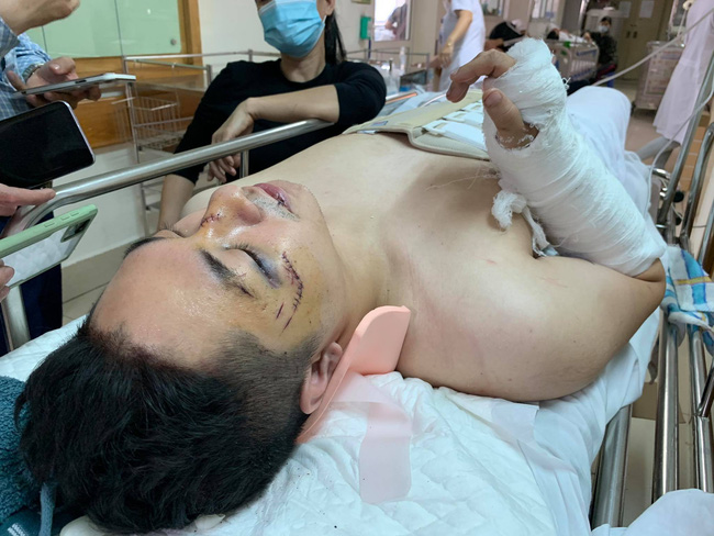 Anh Hiếu đang được điều trị tại bệnh viện.