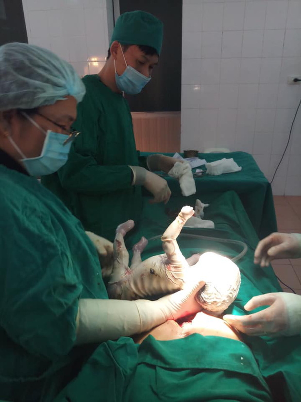 Bệnh nhi sinh ra có lớp da nứt nẻ, được chẩn đoán mắc bệnh da vảy cá (Ảnh: BVCC)