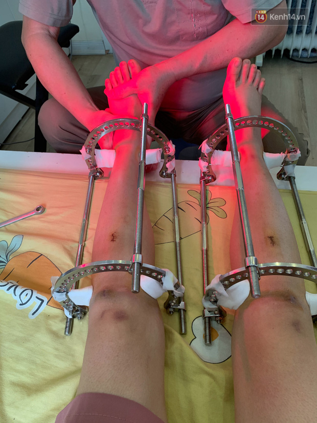 Tâm phải trả 400-500k/lần cho một buổi vật lý trị liệu