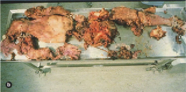 Nội tạng của nạn nhân được tìm thấy sau vụ nổ