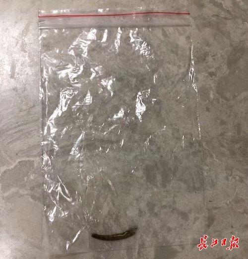 Mảnh xương cá dài 3cm của anh Vương.