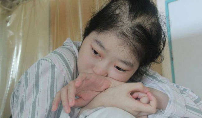 Tiểu Linh 18 tuổi đã bị mắc ung thư dạ dày