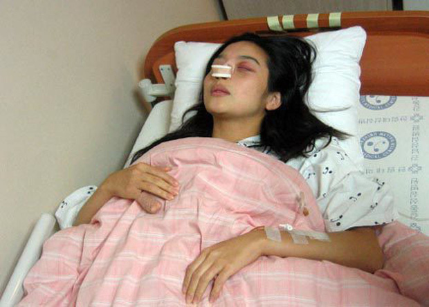 Cô đã bị chồng hành hung dã man