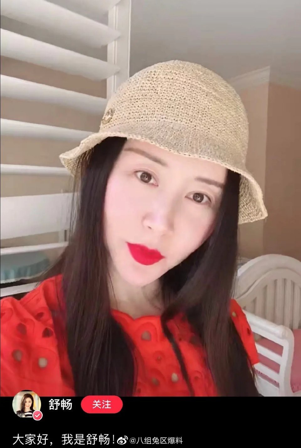 Lạm dụng phẫu thuật thẩm mỹ khiến gương mặt Thư Sướng biến dạng.