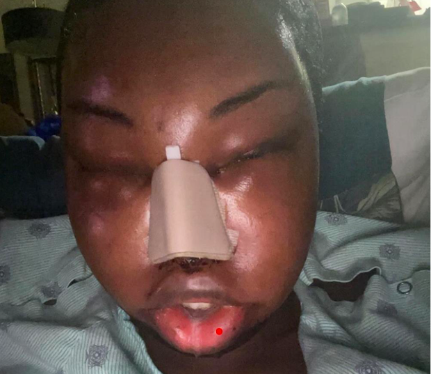 Hình ảnh này khiến người hâm mộ Jazell Barbie Royale không khỏi lo lắng