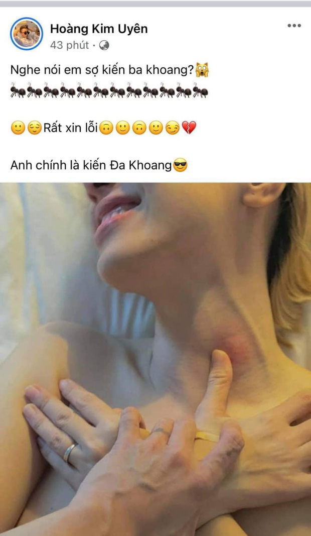 Trước đó, Miko Lan Trinh và Kenji thường đăng tải những bức ảnh mang tính chất 18+ khiến dân tình phát sốt. Tuy nhiên không ít ý kiến cho rằng cặp đôi này đang sa đà vào những hình ảnh phản cảm