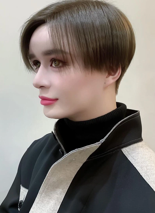 Hiện tại anh chàng sở hữu gương mặt đơ cứng, thiếu tự nhiên