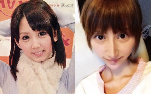 Nhan sắc trước và sau khi dao kéo của Rumi