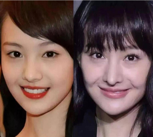 Nữ diễn viên không còn giữ được nét đẹp năm xưa, thay vào đó là sống mũi mới đơ cứng, nhọn hoắt