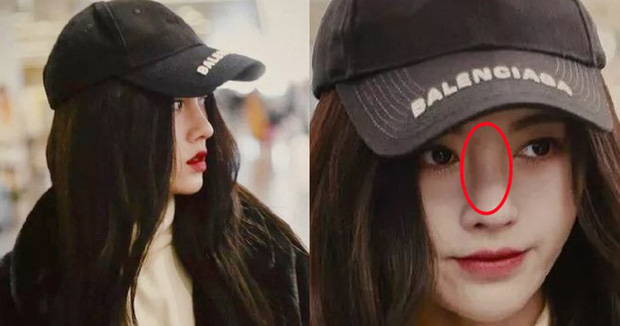 Cúc Tịnh Y bỗng dưng sưng mũi, gương mặt trở nên mất cân đối hoàn toàn