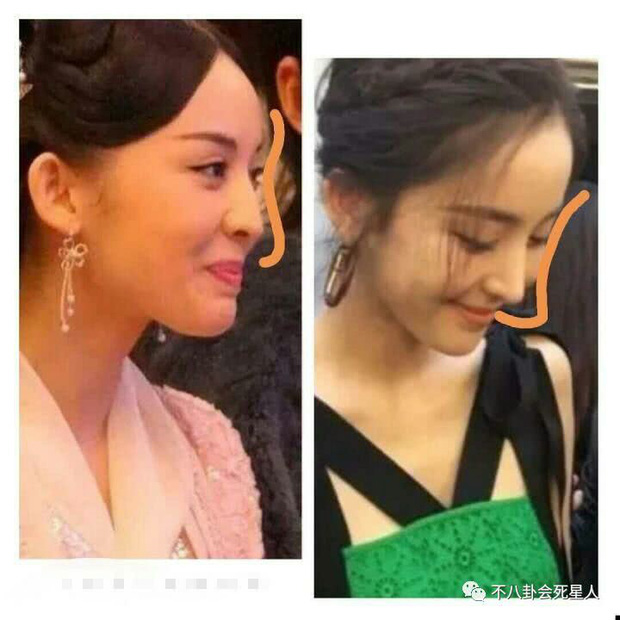 Nữ diễn viên bị soi ảnh sống mũi ngày xưa bị gãy 1 chút nhẹ và khá thấp, trong khi đó giờ đây Na Trát lại sở hữu sống mũi thẳng tắp, có phần nhọn hoắt