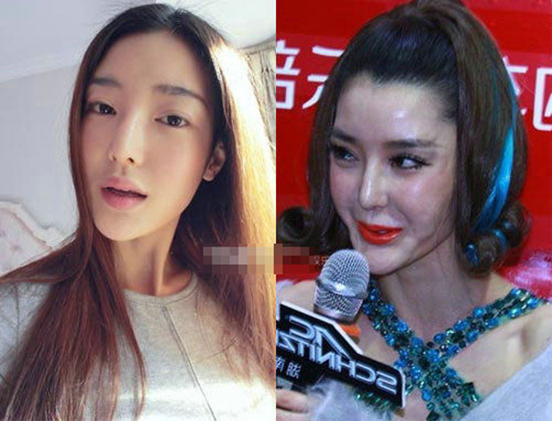 Từ 1 mỹ nhân sở hữu visual ấn tượng, được coi là bản sao của Đại S, vậy nhưng Lý Dĩnh Chi khiến người hâm mộ hoảng hốt vì gương mặt của ngày càng già nua và biến dạng