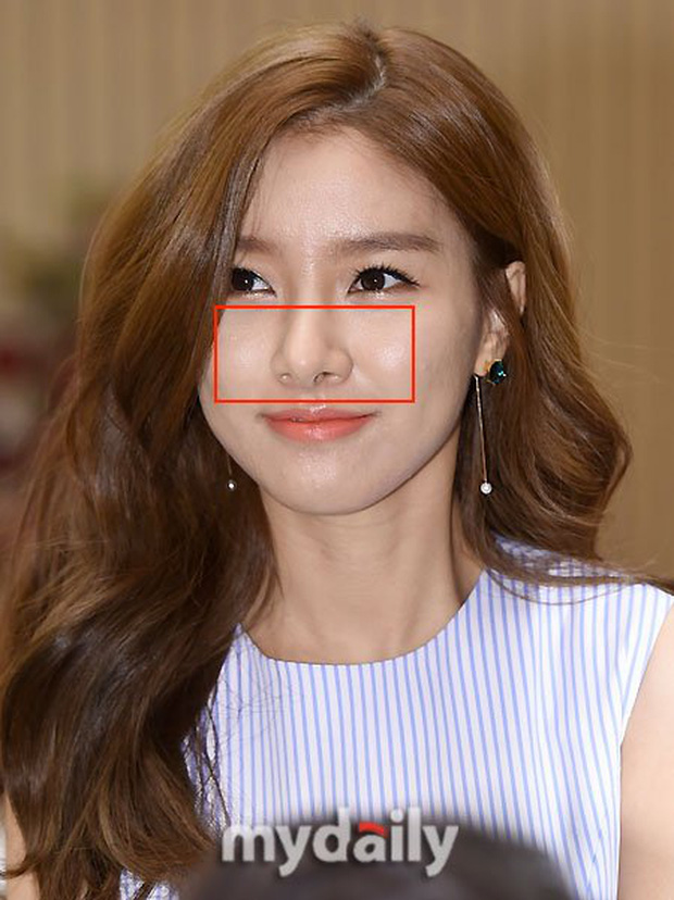 Trong các sự kiện họp báo, cô nàng trở thành tâm điểm vì phần mũi to nhỏ không đều, đầu mũi lồi ra đằng trước 1 cách khó hiểu